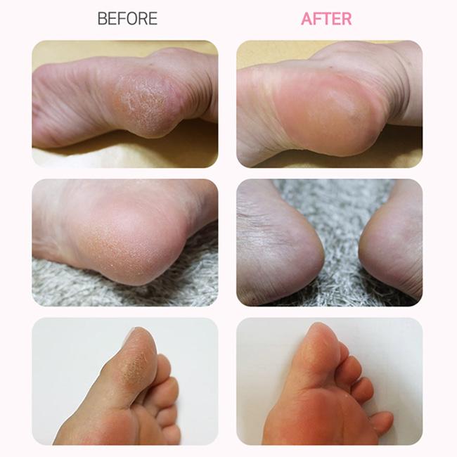 3b68b6fc8b387a4494a55f689e08bc21